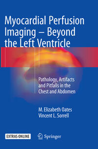 Myocardial Perfusion Imaging - Beyond the Left Ventricle