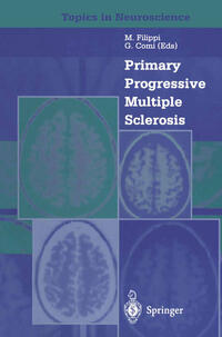 Primary Progressive Multiple Sclerosis