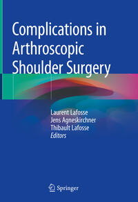 Complications in Arthroscopic Shoulder Surgery