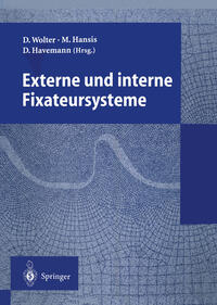 Externe und interne Fixateursysteme