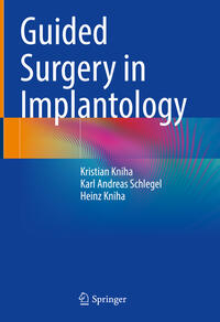 Guided Surgery in Implantology