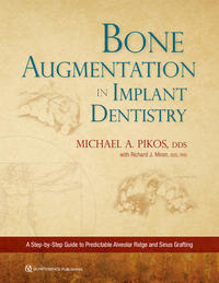 Bone Augmentation in Implant Dentistry