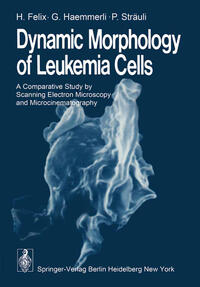 Dynamic Morphology of Leukemia Cells