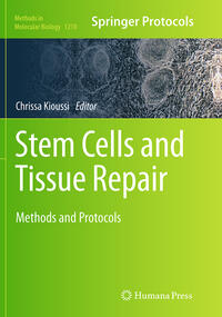 Stem Cells and Tissue Repair