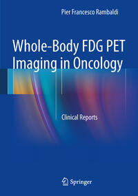 Whole-Body FDG PET Imaging in Oncology