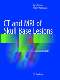 CT and MRI of Skull Base Lesions