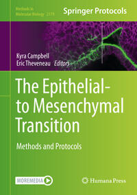 The Epithelial-to Mesenchymal Transition