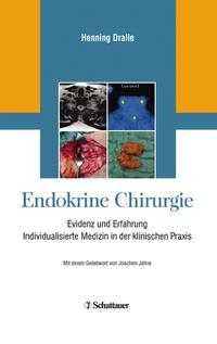 Endokrine Chirurgie