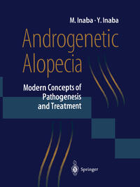 Androgenetic Alopecia