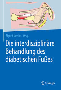 Die interdisziplinäre Behandlung des diabetischen Fußes