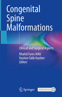 Congenital Spine Malformations