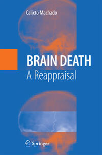 Brain Death