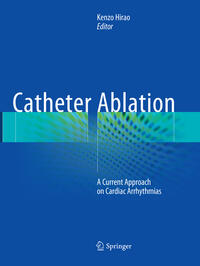 Catheter Ablation