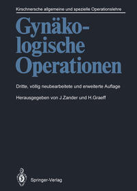 Gynäkologische Operationen