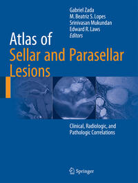 Atlas of Sellar and Parasellar Lesions