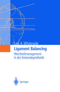 Ligament Balancing