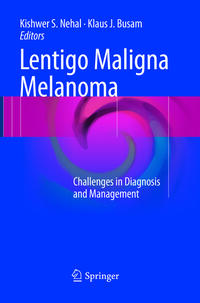 Lentigo Maligna Melanoma