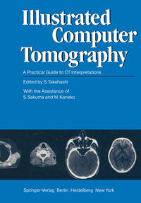 Illustrated Computer Tomography