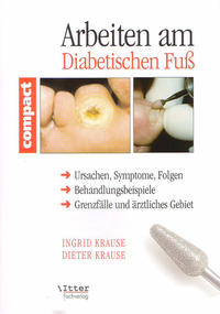 Arbeiten am Diabetischen Fuss