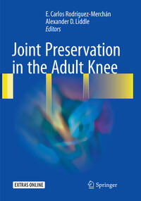 Joint Preservation in the Adult Knee