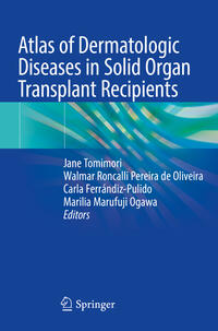 Atlas of Dermatologic Diseases in Solid Organ Transplant Recipients