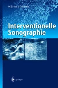 Interventionelle Sonographie