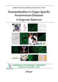 Autoantibodies in Organ Specific Autoimmune Diseases – A Diagnostic Reference