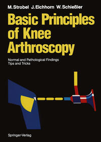 Basic Principles of Knee Arthroscopy