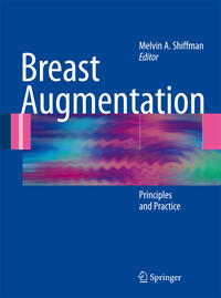 Breast Augmentation