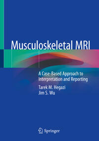 Musculoskeletal MRI