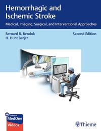 Hemorrhagic and Ischemic Stroke