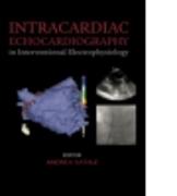 Intracardiac Echocardiography in Interventional Electrophysiology