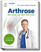 Arthrose