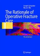 The Rationale of Operative Fracture Care