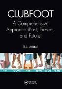 Clubfoot