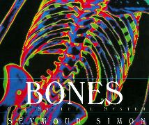 Bones