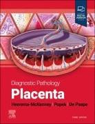 Diagnostic Pathology: Placenta