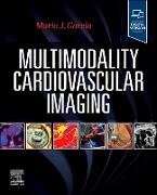 Multimodality Cardiovascular Imaging