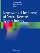 Neurosurgical Treatment of Central Nervous System Tumors