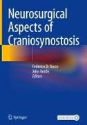 Neurosurgical Aspects of Craniosynostosis